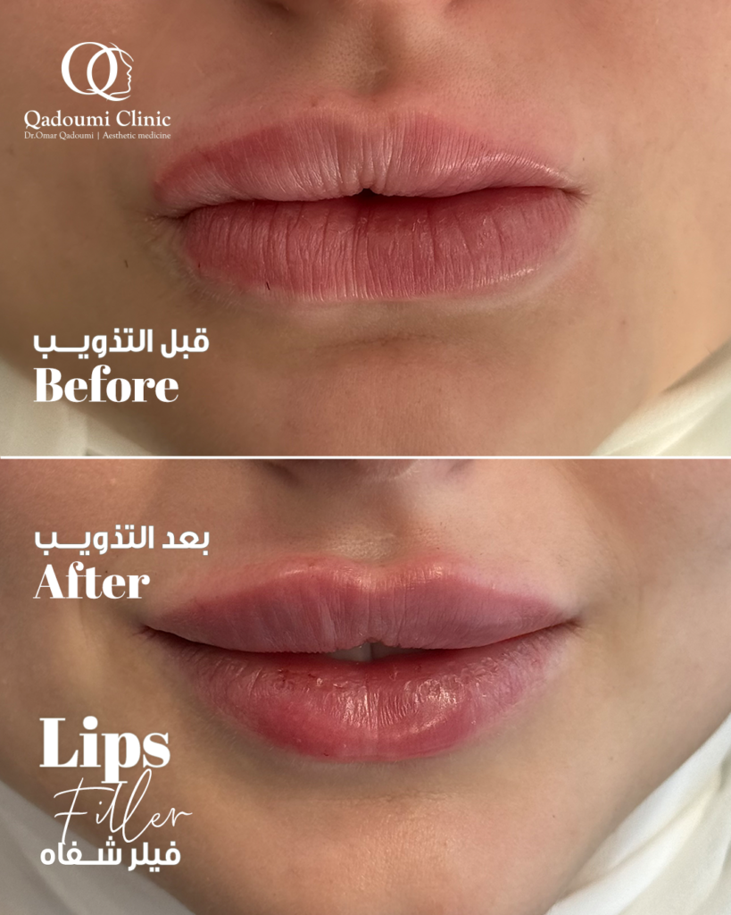 Discover the Magic of Morning Routines: Start Your Day Right