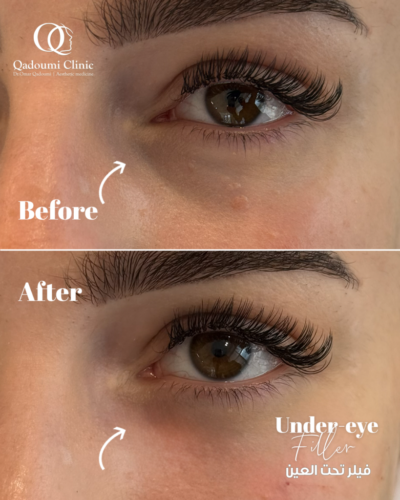 Enhance Your Natural Beauty Safely